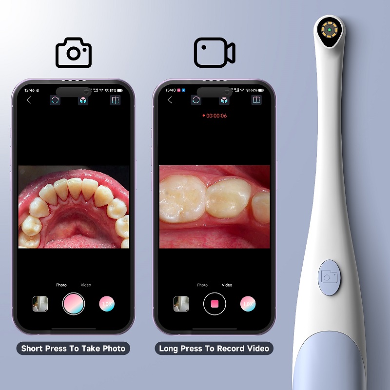 TYPE-C Visual Oral Camera for  - Endoscope Inspection Camera recension och pris